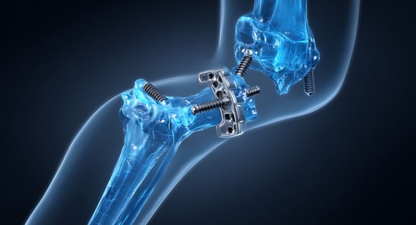 Setting, Technique, and Technology: Drivers of Orthopedic Design in 2026